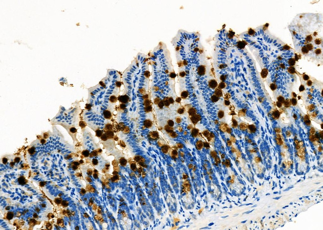 TrxR1 Antibody in Immunohistochemistry (Paraffin) (IHC (P))