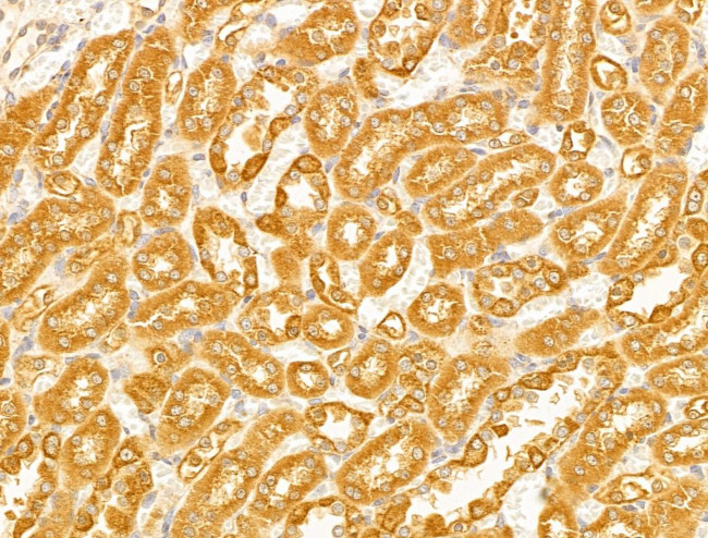 VDAC2 Antibody in Immunohistochemistry (Paraffin) (IHC (P))