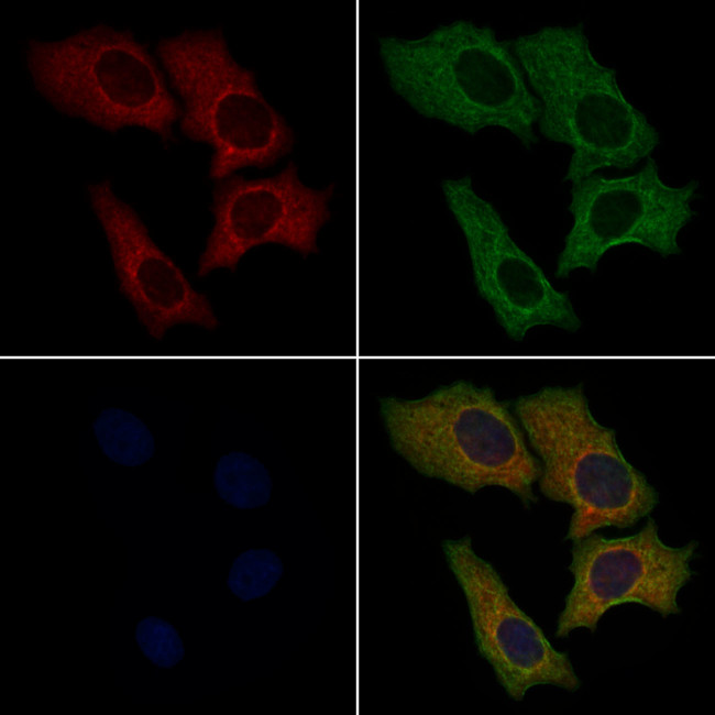 Wnt10B Antibody in Immunocytochemistry (ICC/IF)