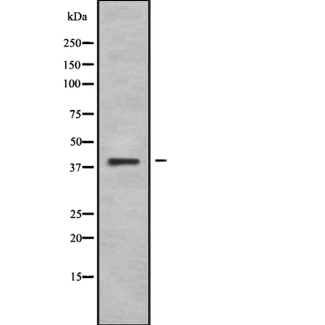 Wnt10B Antibody in Western Blot (WB)