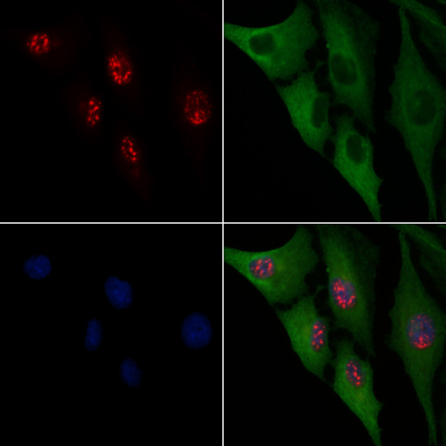 WT1 Antibody in Immunocytochemistry (ICC/IF)