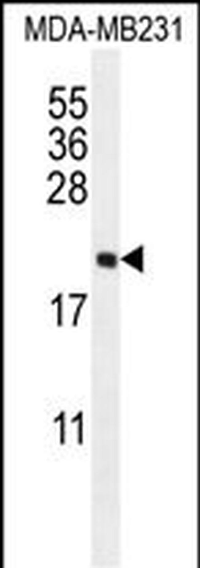 UNQ3104 Antibody in Western Blot (WB)