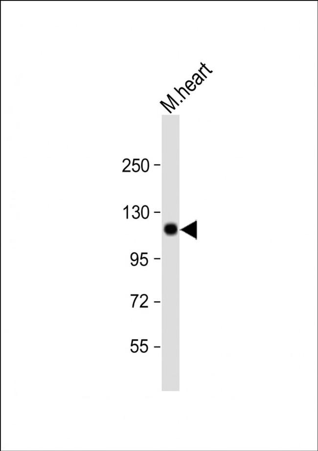 SCYL2 Antibody in Western Blot (WB)