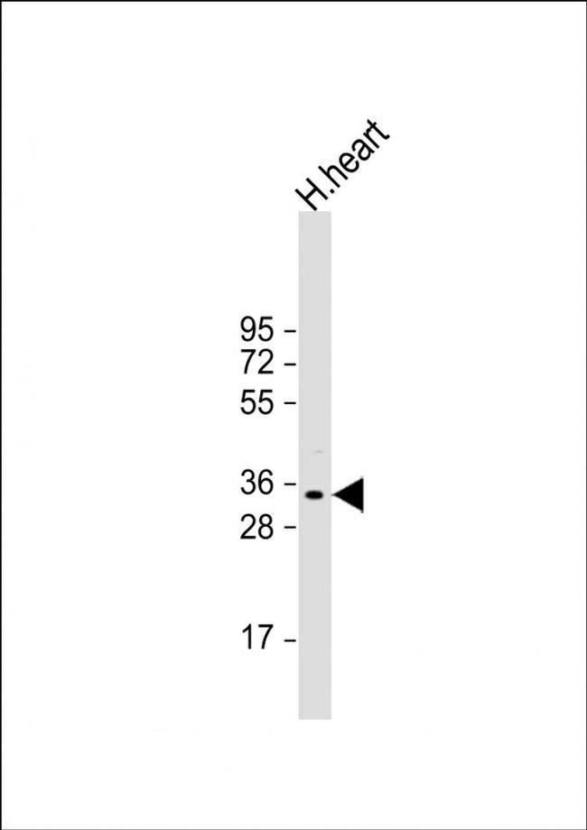 Phafin 1 Antibody in Western Blot (WB)