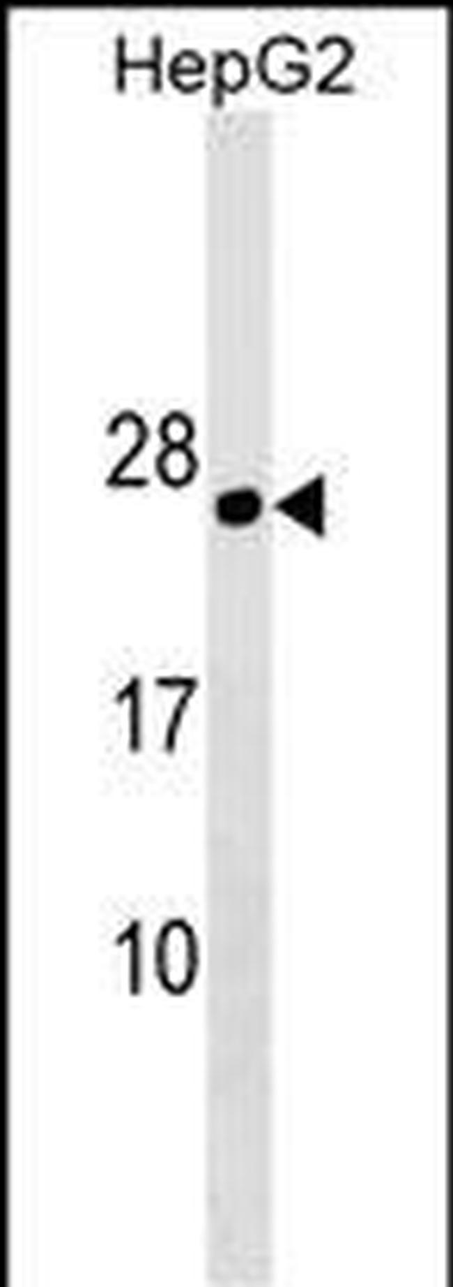 PLLP Antibody in Western Blot (WB)