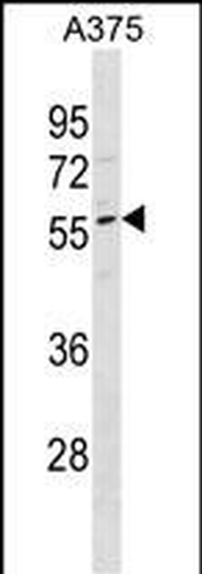 DPCR1 Antibody in Western Blot (WB)