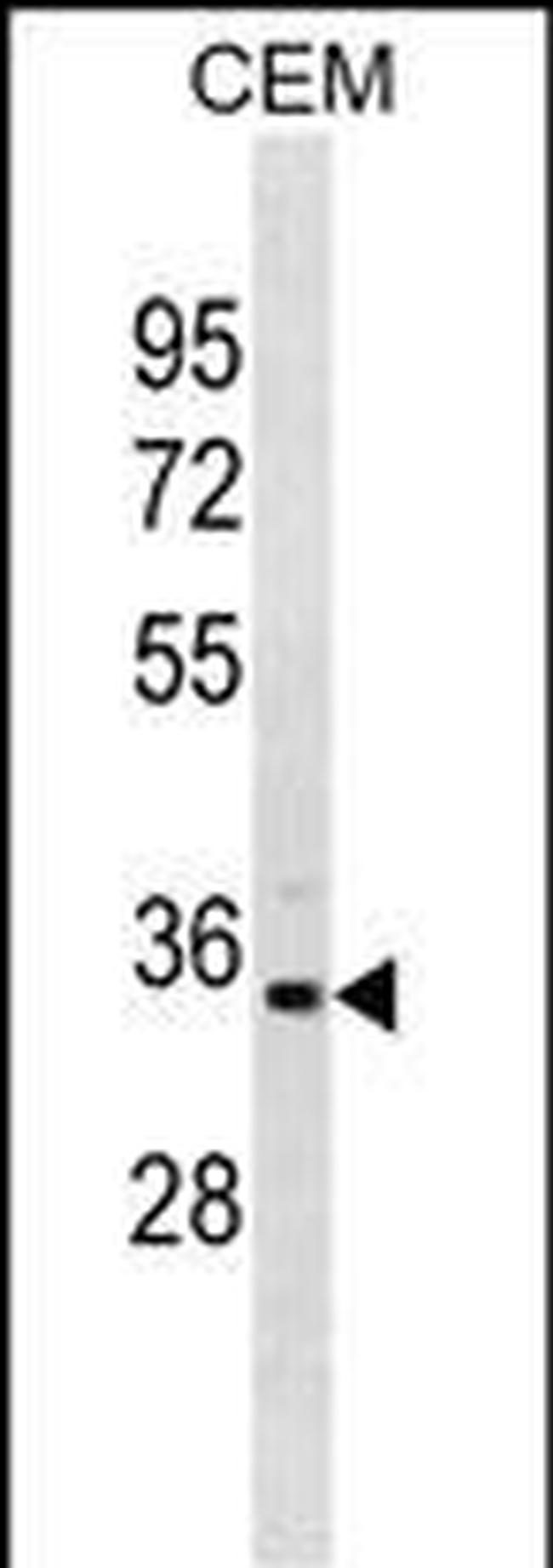 PRPS1L1 Antibody in Western Blot (WB)