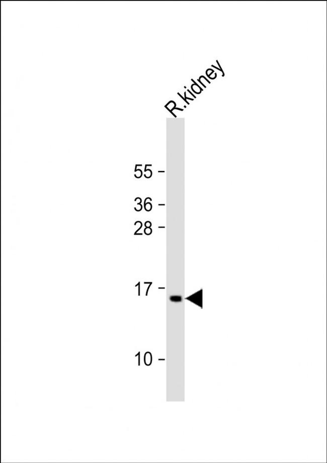 ATP5G3 Antibody in Western Blot (WB)