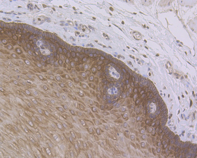 Cytokeratin 5/6 Antibody in Immunohistochemistry (Paraffin) (IHC (P))