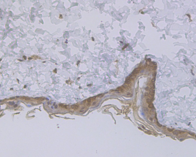 Cytokeratin 5/6 Antibody in Immunohistochemistry (Paraffin) (IHC (P))