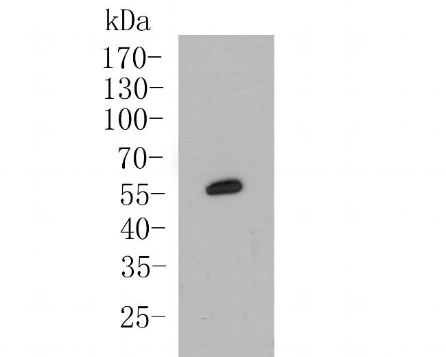 Cytokeratin 5/6 Antibody in Western Blot (WB)