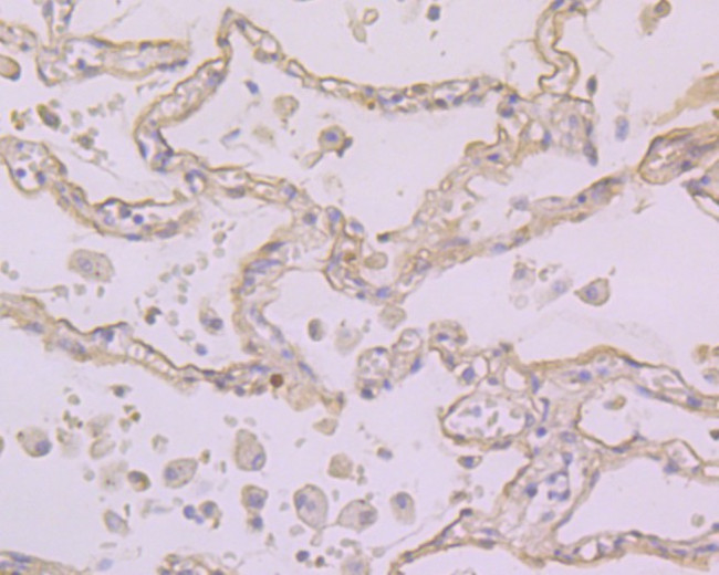 Folate Receptor alpha Antibody in Immunohistochemistry (Paraffin) (IHC (P))