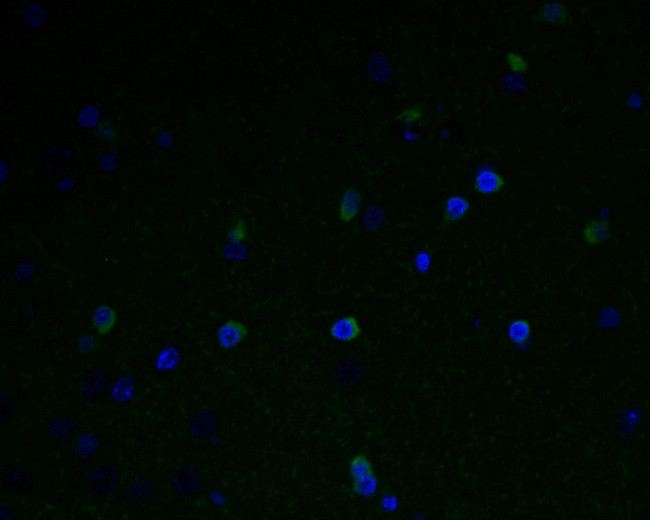 GABRA5 Antibody in Immunohistochemistry (Paraffin) (IHC (P))