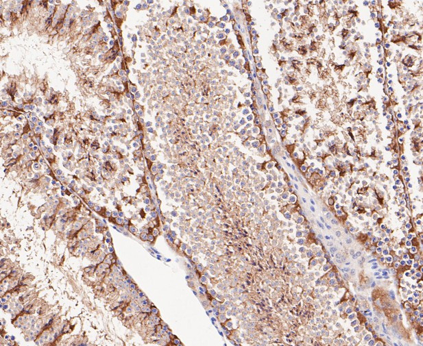 ATG4A Antibody in Immunohistochemistry (Paraffin) (IHC (P))