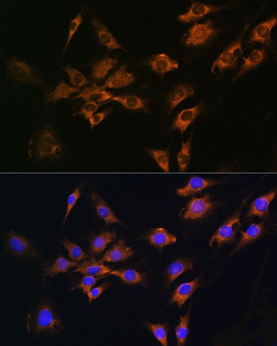 FGF2 Antibody in Immunocytochemistry (ICC/IF)