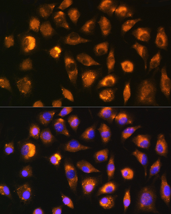 FGF2 Antibody in Immunocytochemistry (ICC/IF)