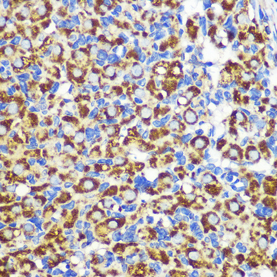 FGF2 Antibody in Immunohistochemistry (Paraffin) (IHC (P))