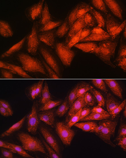 RRP4 Antibody in Immunocytochemistry (ICC/IF)