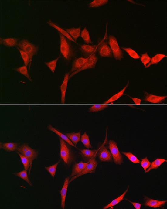 TRIM31 Antibody in Immunocytochemistry (ICC/IF)