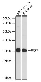 UCP4 Antibody in Western Blot (WB)