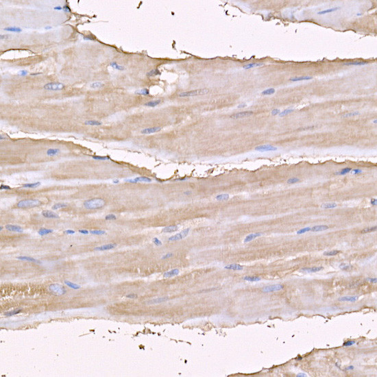 Myosin 4 Antibody in Immunohistochemistry (Paraffin) (IHC (P))