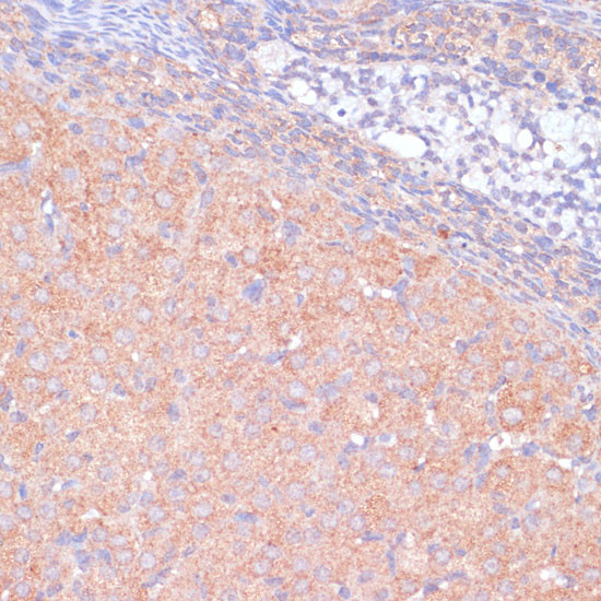 KANK2 Antibody in Immunohistochemistry (Paraffin) (IHC (P))