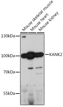 KANK2 Antibody in Western Blot (WB)