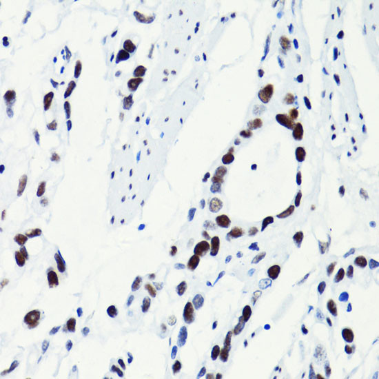 H2BK5ac Antibody in Immunohistochemistry (Paraffin) (IHC (P))