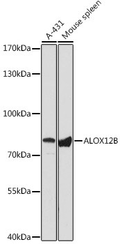 ALOX12B Antibody in Western Blot (WB)