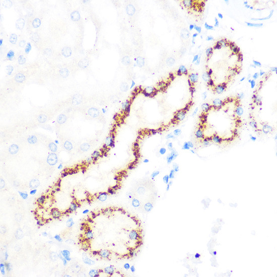 OSR1 Antibody in Immunohistochemistry (Paraffin) (IHC (P))