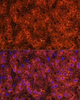 ADH1A/ADH1B/ADH1C Antibody in Immunohistochemistry (Paraffin) (IHC (P))