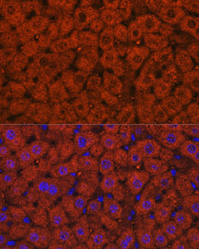 ADH1A/ADH1B/ADH1C Antibody in Immunohistochemistry (Paraffin) (IHC (P))