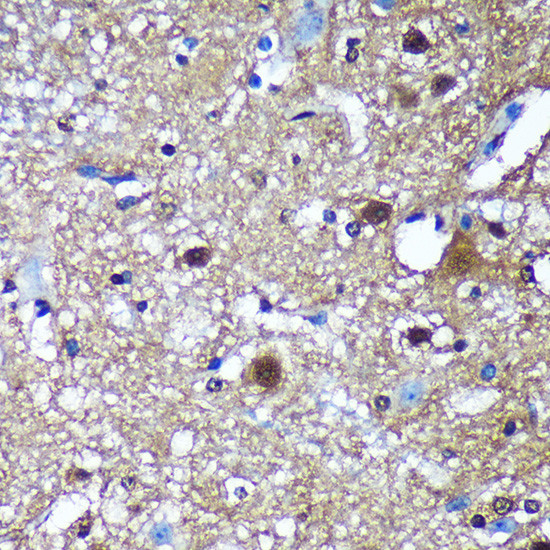 TSN Antibody in Immunohistochemistry (Paraffin) (IHC (P))