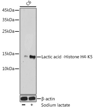 Lactyl-Histone H4 (Lys5) Antibody in Western Blot (WB)