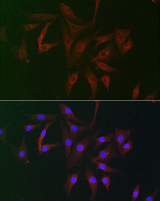 RAI16 Antibody in Immunocytochemistry (ICC/IF)