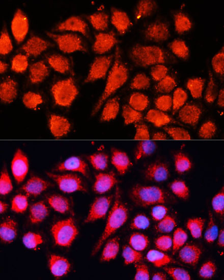 RT28 Antibody in Immunocytochemistry (ICC/IF)