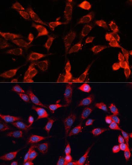 RT28 Antibody in Immunocytochemistry (ICC/IF)