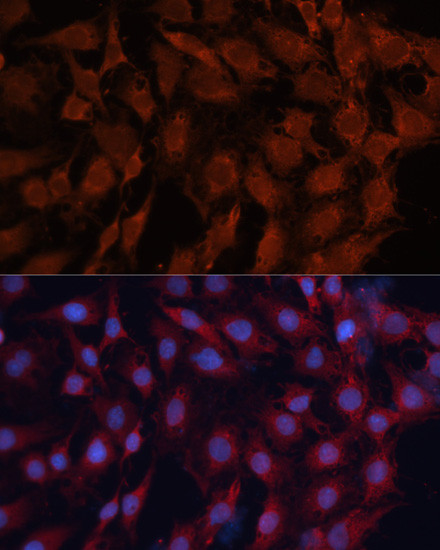 HSP40 Antibody in Immunocytochemistry (ICC/IF)