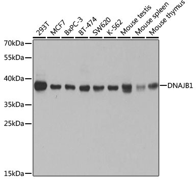 HSP40 Antibody in Western Blot (WB)