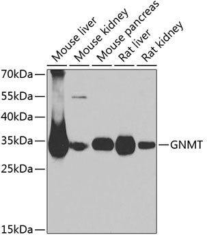 GNMT Antibody in Western Blot (WB)