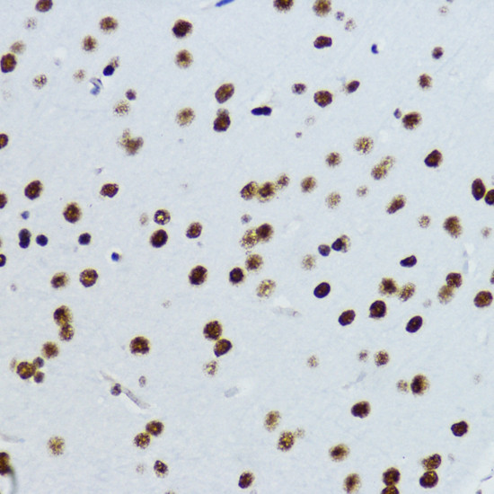 H3K9ac Antibody in Immunohistochemistry (Paraffin) (IHC (P))