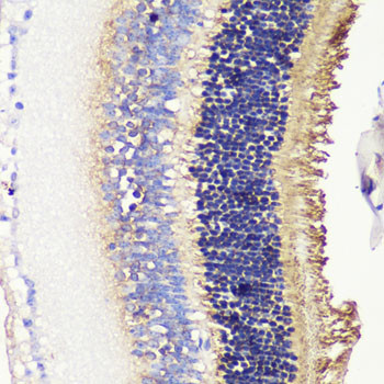 PDC Antibody in Immunohistochemistry (Paraffin) (IHC (P))