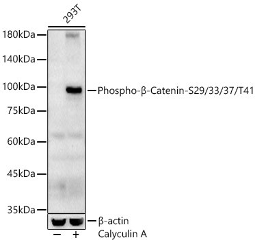 Phospho-beta Catenin (Ser29, Ser33, Ser37, Thr41) Antibody in Western Blot (WB)