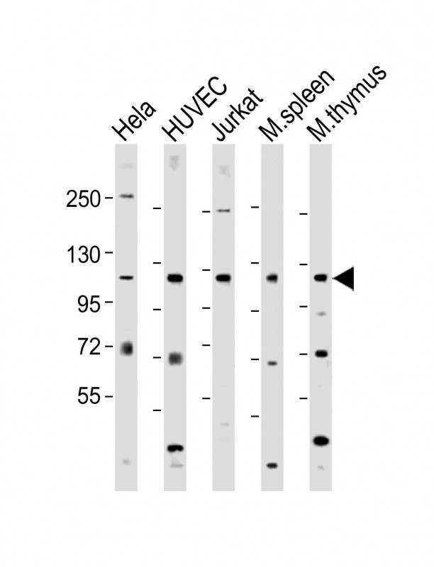 RIG-I Antibody in Western Blot (WB)