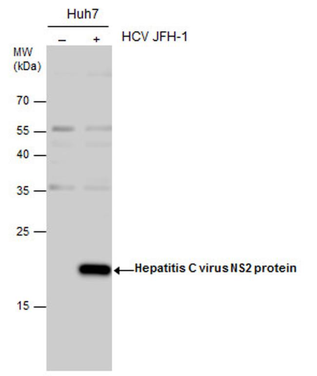 Hepatitis C Virus NS2 Antibody in Western Blot (WB)