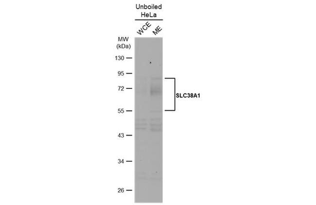 SLC38A1 Antibody in Western Blot (WB)