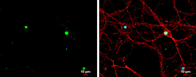 TBR1 Antibody in Immunocytochemistry (ICC/IF)