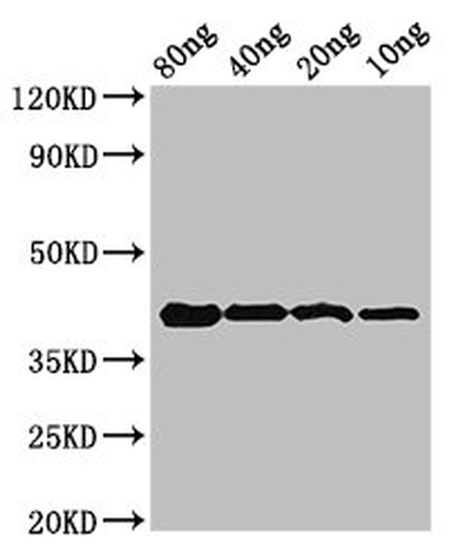 Chlamydia trachomatis OmcB Antibody in Western Blot (WB)