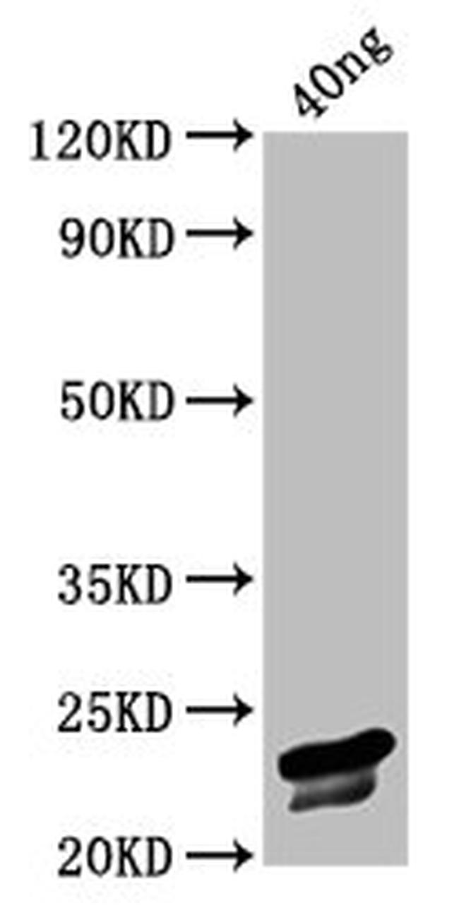 Chicken Anemia Virus VP3 Antibody in Western Blot (WB)