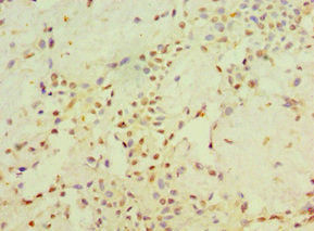 STARD3 Antibody in Immunohistochemistry (Paraffin) (IHC (P))